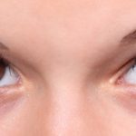 Sådan virker botulinum toxin i botoxbehandlinger Sådan virker botulinum toxin i botoxbehandlinger